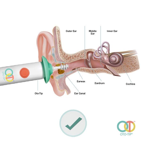 Diagram showing how OTO-Tip works to clean your ear.